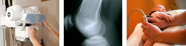 Grafik Allgemeine Leistungen